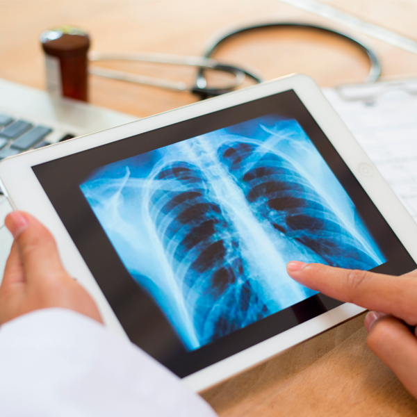 RX Radiología